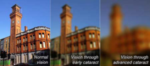 vision-through-cataract